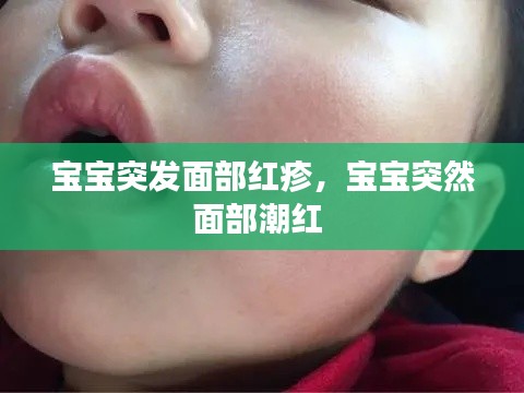 宝宝突发面部红疹，宝宝突然面部潮红 