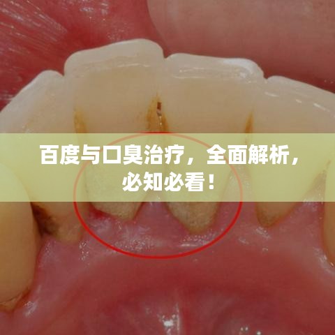 百度与口臭治疗,全面解析,必知必看!